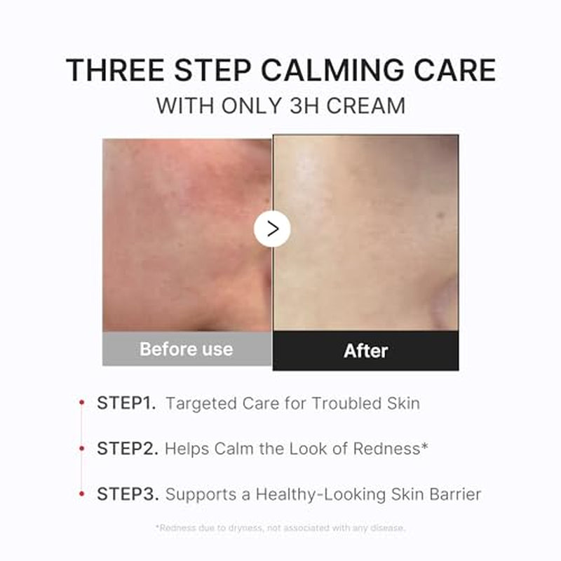 3H Daily Relief Cream and Hypochlorous Acid Power Soothing Spray 
