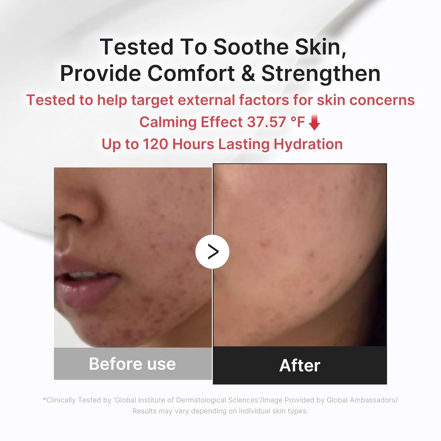3H Daily Relief Cream and Hypochlorous Acid Power Soothing Spray 
