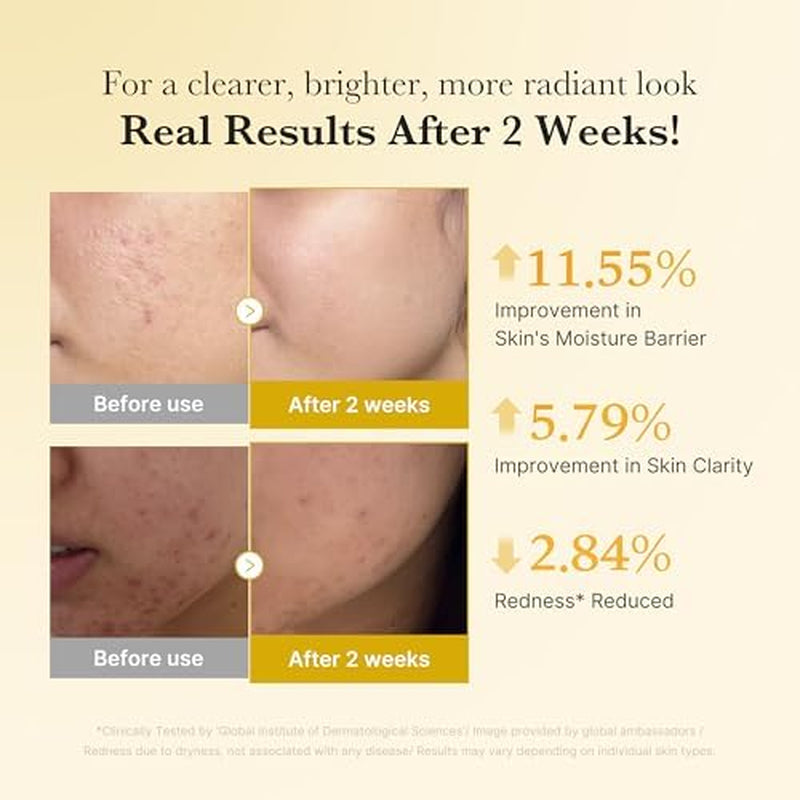 Kojic Acid Turmeric Clarifying & Balancing Capsule Serum