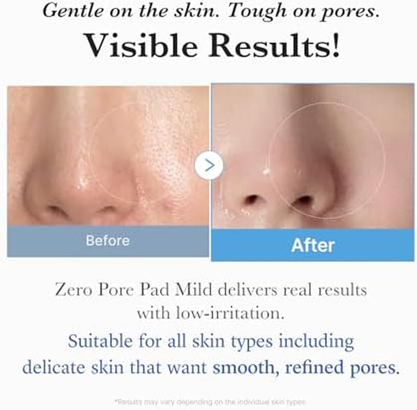Zero Pore Pad Mild and Zero Foam Cleanser 