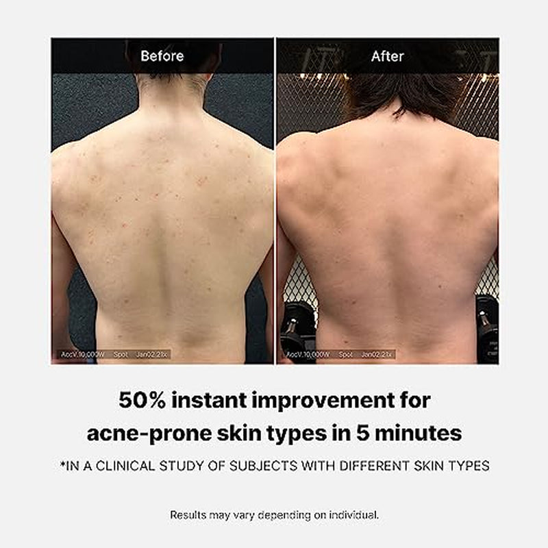 Peeling Shot Body Spray Cleanser + Red Body Wash