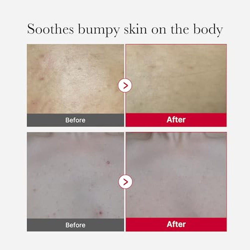 Peeling Shot Body Spray Cleanser + Red Body Wash