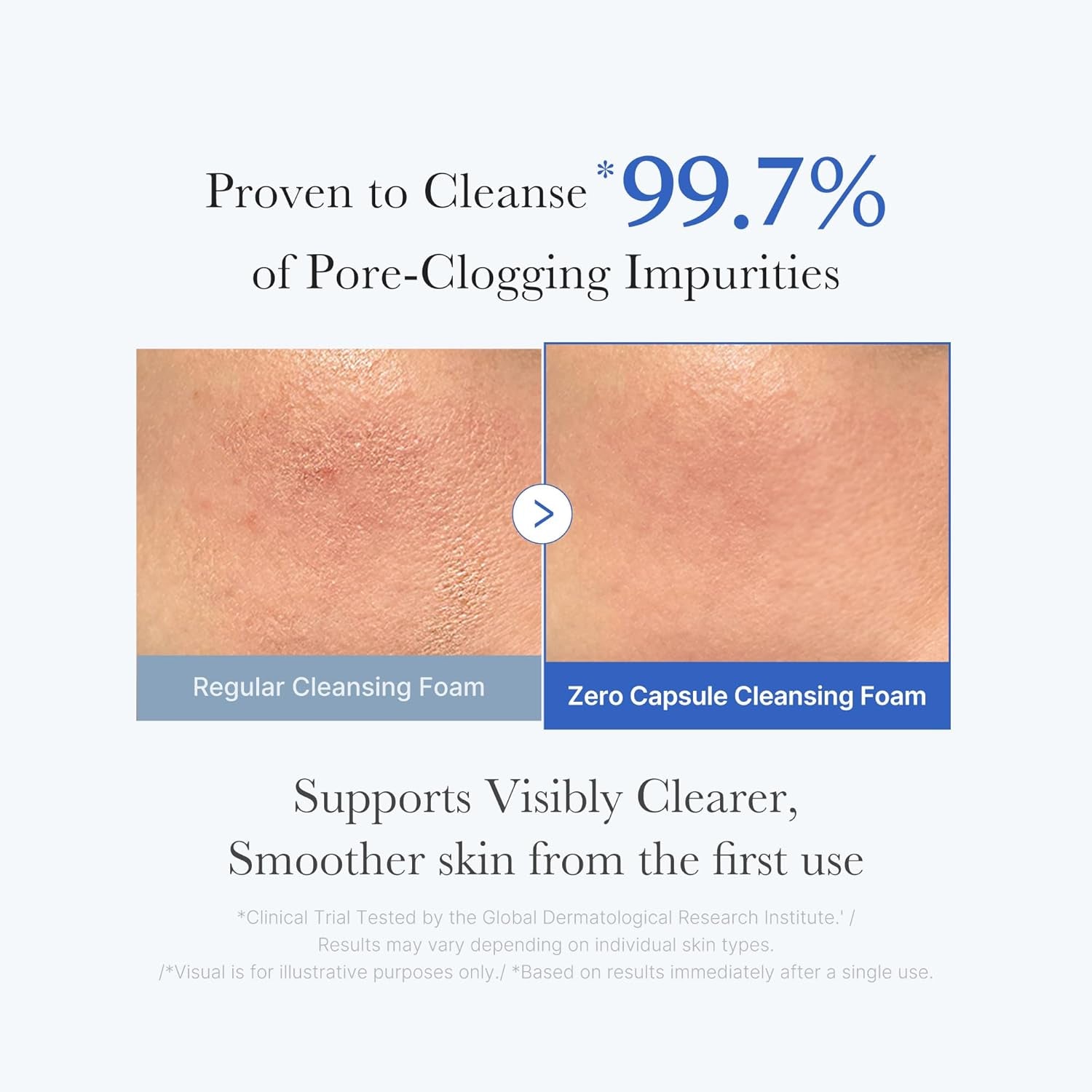 Capsule Foam Cleanser Trio: Zero Pore, Kojic Acid Turmeric, and PDRN Capsule Foam Cleanser 