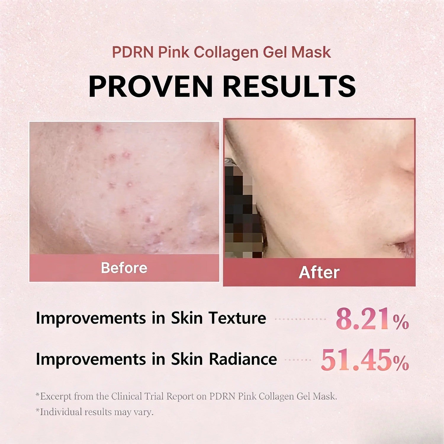 Salmon PDRN Pink Collagen Mask